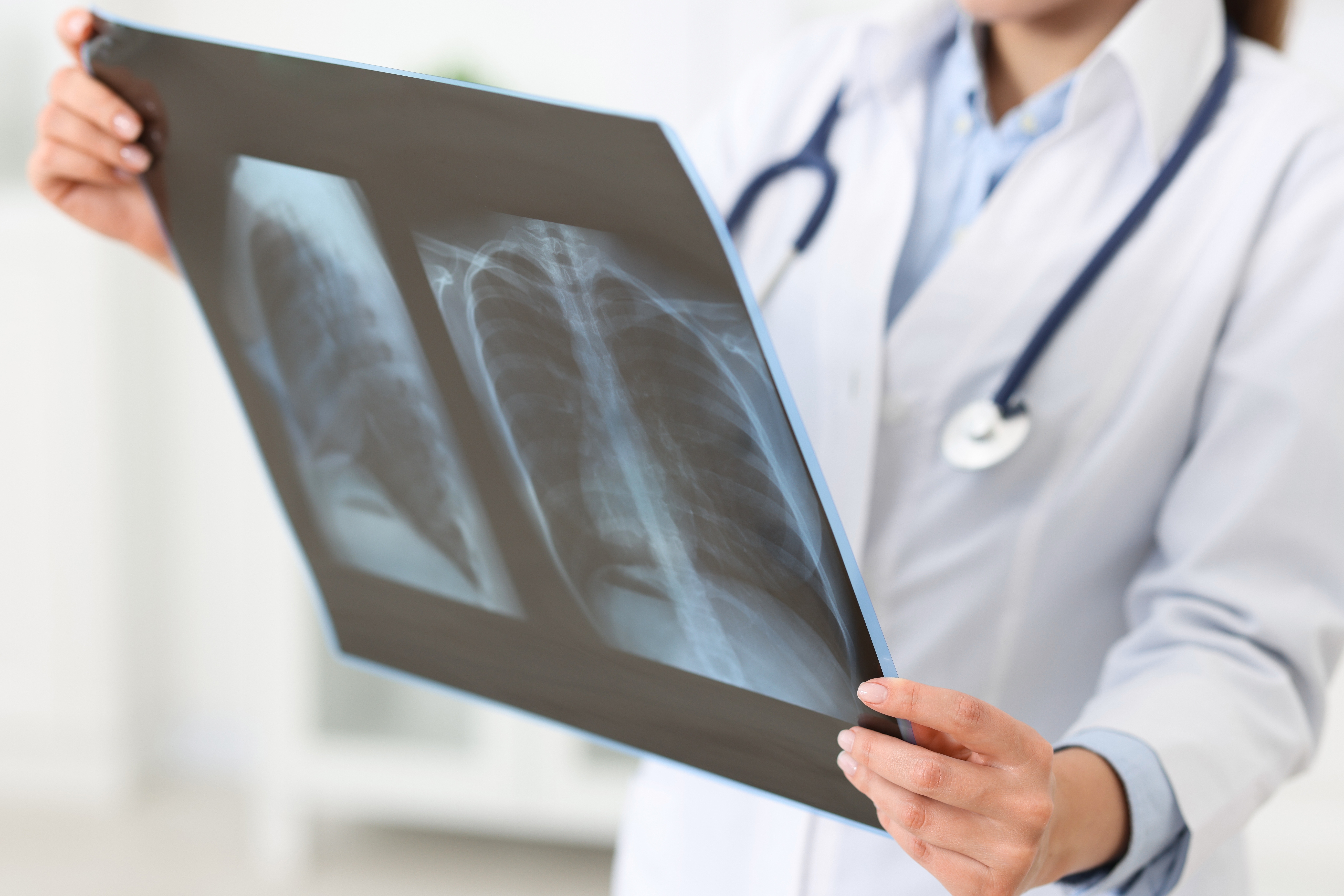 Why Indian Employers Are Adding Onsite Imaging for Executive Health Check to Their Leadership Wellness Strategy