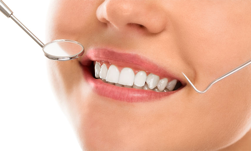 Smile without a worry: 4 Dental problems and their solutions